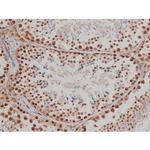 Phospho-IGF1R (Tyr1346) Antibody in Immunohistochemistry (Paraffin) (IHC (P))