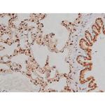 Phospho-IGF1R (Tyr1346) Antibody in Immunohistochemistry (Paraffin) (IHC (P))