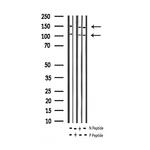 Phospho-IGF1R (Tyr1346) Antibody in Western Blot (WB)