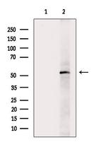 Phospho-EpoR (Tyr368) Antibody in Western Blot (WB)