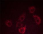 Phospho-CXCR2 (Ser347) Antibody in Immunocytochemistry (ICC/IF)