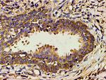 Phospho-PI3K p85 alpha (Tyr607) Antibody in Immunohistochemistry (Paraffin) (IHC (P))