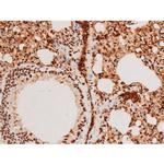 Phospho-SYK (Tyr348) Antibody in Immunohistochemistry (Paraffin) (IHC (P))