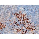 Phospho-SYK (Tyr348) Antibody in Immunohistochemistry (Paraffin) (IHC (P))