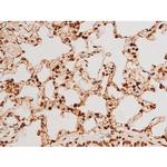 Phospho-SYK (Tyr348) Antibody in Immunohistochemistry (Paraffin) (IHC (P))