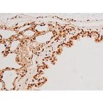 Phospho-SYK (Tyr348) Antibody in Immunohistochemistry (Paraffin) (IHC (P))