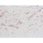 Phospho-SYK (Tyr348) Antibody in Immunohistochemistry (Paraffin) (IHC (P))