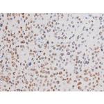 Phospho-LIMK2 (Ser283) Antibody in Immunohistochemistry (Paraffin) (IHC (P))