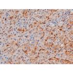 Phospho-LIMK2 (Ser283) Antibody in Immunohistochemistry (Paraffin) (IHC (P))