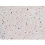 Phospho-LIMK2 (Ser283) Antibody in Immunohistochemistry (Paraffin) (IHC (P))