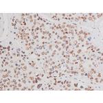 Phospho-LIMK2 (Ser283) Antibody in Immunohistochemistry (Paraffin) (IHC (P))