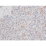 Phospho-LIMK2 (Ser283) Antibody in Immunohistochemistry (Paraffin) (IHC (P))