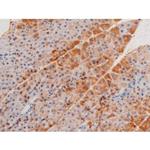 Phospho-LIMK2 (Ser283) Antibody in Immunohistochemistry (Paraffin) (IHC (P))