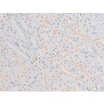 Phospho-LIMK2 (Ser283) Antibody in Immunohistochemistry (Paraffin) (IHC (P))