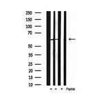 Phospho-HDAC2 (Ser394) Antibody in Western Blot (WB)