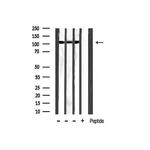 Phospho-HDAC5 (Ser259) Antibody in Western Blot (WB)