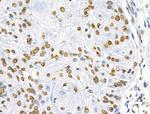 Phospho-SRF (Ser103) Antibody in Immunohistochemistry (Paraffin) (IHC (P))