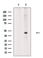 Phospho-PAR4 (Thr163) Antibody in Western Blot (WB)