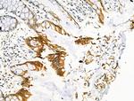 Phospho-RAD18 (Ser403) Antibody in Immunohistochemistry (Paraffin) (IHC (P))