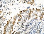 Phospho-RAD18 (Ser403) Antibody in Immunohistochemistry (Paraffin) (IHC (P))