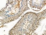 Phospho-RAD18 (Ser403) Antibody in Immunohistochemistry (Paraffin) (IHC (P))