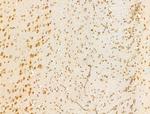 HDAC5 Antibody in Immunohistochemistry (Paraffin) (IHC (P))