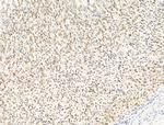 HDAC5 Antibody in Immunohistochemistry (Paraffin) (IHC (P))