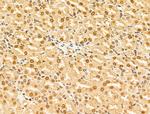 HDAC5 Antibody in Immunohistochemistry (Paraffin) (IHC (P))