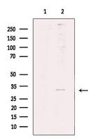 MARCKS Antibody in Western Blot (WB)