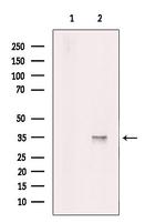 PRPS1 Antibody in Western Blot (WB)