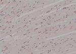 Phospho-CTGF (Ser118) Antibody in Immunohistochemistry (Paraffin) (IHC (P))