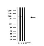 Phospho-HCN1 (Ser846) Antibody in Western Blot (WB)