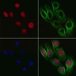 Phospho-NBS1 (Ser432) Antibody in Immunocytochemistry (ICC/IF)