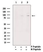 Phospho-NBS1 (Ser432) Antibody in Western Blot (WB)