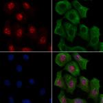 Phospho-RAD17 (Ser86) Antibody in Immunocytochemistry (ICC/IF)