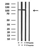 Phospho-ATP1A1 (Tyr260) Antibody in Western Blot (WB)