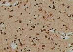 Phospho-EPRS (Tyr377) Antibody in Immunohistochemistry (Paraffin) (IHC (P))