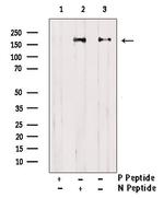 Phospho-EPRS (Tyr377) Antibody in Western Blot (WB)