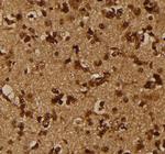 Phospho-Lyn (Tyr193) Antibody in Immunohistochemistry (Paraffin) (IHC (P))