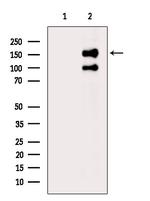 Phospho-NMDAR2B (Ser1303) Antibody in Western Blot (WB)