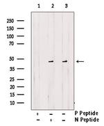 Phospho-CaMKII alpha/beta/delta (Ser235) Antibody in Western Blot (WB)