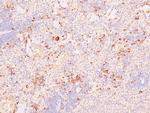 Phospho-NFkB p105 (Ser923) Antibody in Immunohistochemistry (Paraffin) (IHC (P))