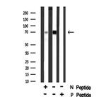 Phospho-KV4.2 (KCND2) (Ser616) Antibody in Western Blot (WB)