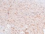 Phospho-PDPK1 (Tyr376) Antibody in Immunohistochemistry (Paraffin) (IHC (P))