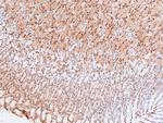 Phospho-PDPK1 (Tyr376) Antibody in Immunohistochemistry (Paraffin) (IHC (P))