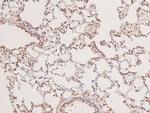 Phospho-MST3 (Thr18) Antibody in Immunohistochemistry (Paraffin) (IHC (P))