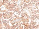 Phospho-ROS1 (Tyr2274) Antibody in Immunohistochemistry (Paraffin) (IHC (P))