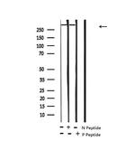 Phospho-ROS1 (Tyr2274) Antibody in Western Blot (WB)