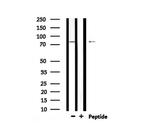 Phospho-SIK1 (Thr182) Antibody in Western Blot (WB)