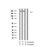 Phospho-BRCA1 (Ser1387) Antibody in Western Blot (WB)